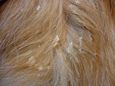 De huid van de hond en kat